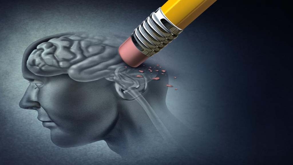 El mal d’Alzheimer